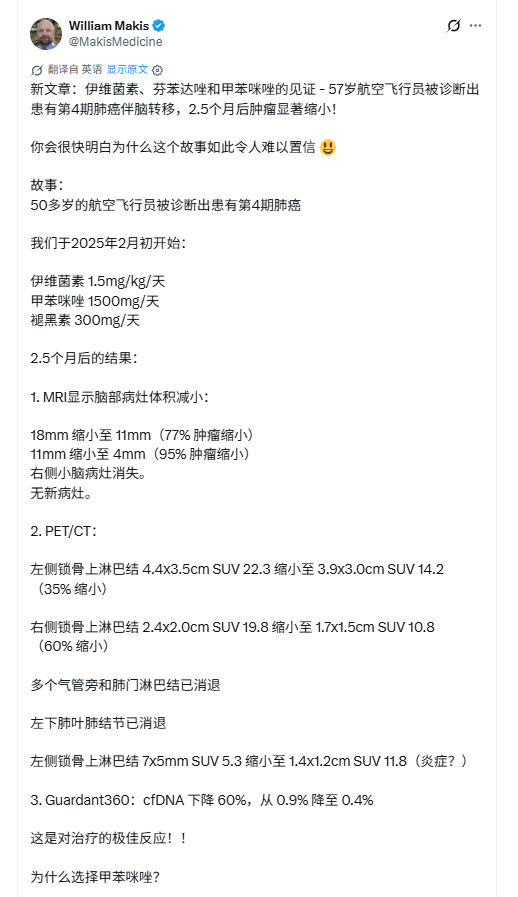 4期肺癌案例